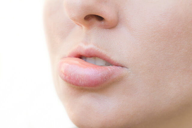 Sports Injury: How to Reduce a Swollen Lip – Bedside Pain Manager